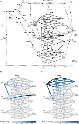 Computational Network Modeling of Intranidal Hemodynamic Compartmentalization in a Theoretical Three-Dimensional Brain Arteriovenous Malformation